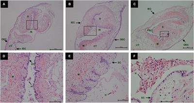 Histological and Comparative Transcriptome Analyses Provide Insights Into the Immune Response in Pearl Sac Formation of Hyriopsis cumingii